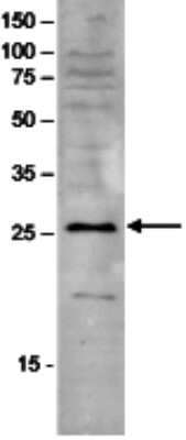 Western Blot: SAP30 Antibody [NBP3-18645] - Figure 1. Western blot analysis using the antibody directed against SAP30 Western blot was performed on nuclear extracts from HeLa cells (HeLa NE, 20 ug) using the antibody against SAP30 diluted 1:1000 in TBS-Tween containing 5% skimmed milk. The molecular weight marker (in kDa) is shown on the left; the location of the protein of interest is indicated on the right.